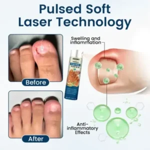 NailGuard Fungal Repair Herbal Spray - Image 4