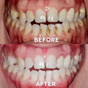 Tooth Health Mineral Powder - Image 2