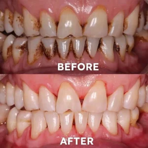 Tooth Health Mineral Powder - Image 4