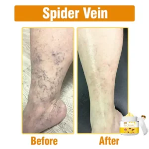 Bee Venom Comprehensive Cream - Image 6
