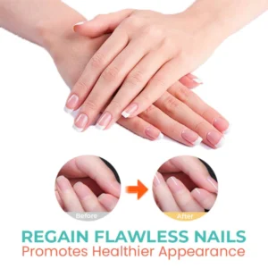XtraRich Vitamin Nail Strengthening Cuticle Oil - Image 3