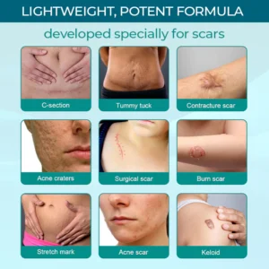 Medical Scar Removal Spray - Image 4