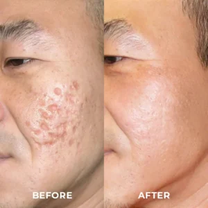 Medical Scar Removal Spray - Image 7