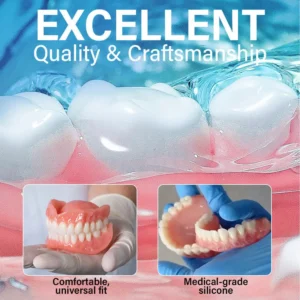 Suction-fit Complete Denture - Image 3