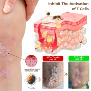 PsoriX Bee Venom Cream - Image 5