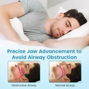QIAWI ™ Anti-Snoring & Anti-Grinding Teeth Protector - Image 6