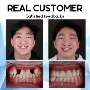 Silicone Denture Set - Image 15