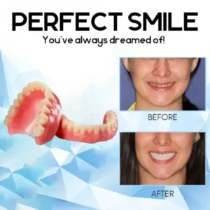 Premium Custom Silicone Denture Set - Image 5
