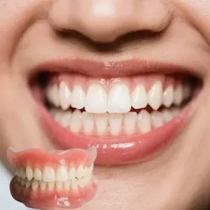 Custom-Fit Full Functional Dentures - Image 3