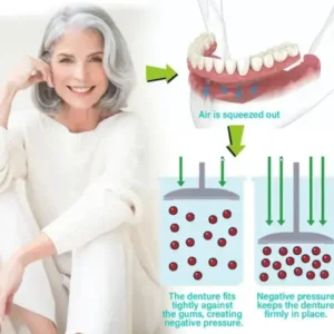 Immediate Dentures - Image 3
