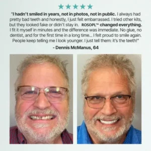 Premium Custom Dentures