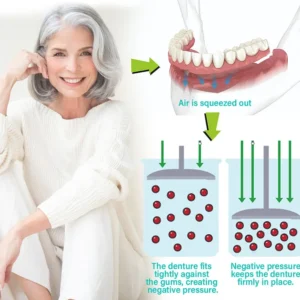 – Immediate Dentures: The Ultimate Fit You Can’t Resist! - Image 3