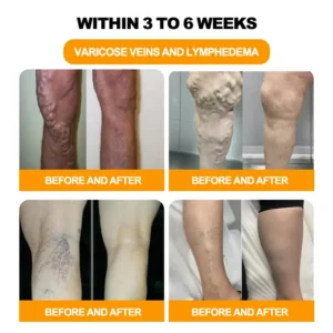 Bee Venom Lymphatic Drainage & Slimming Foot SoakBeads - Image 6