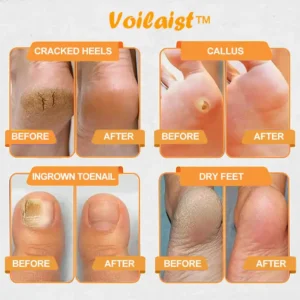 Bee Venom Lymphatic Drainage & Slimming Foot SoakBeads - Image 8