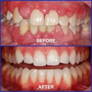 VioGloss Bee Venom Dental Therapy Oral Power - Image 9