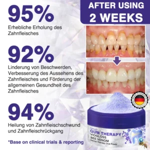 VioGloss Bienengift-Zahntherapie Oral Power - Image 5