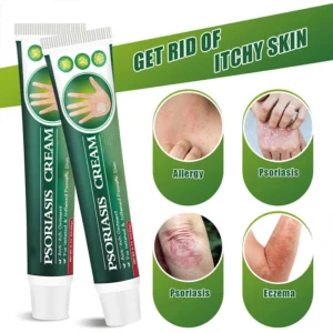 Psoriasis Treatment Cream - Image 2
