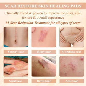 SiliconeFoam Healing Pads - Image 10