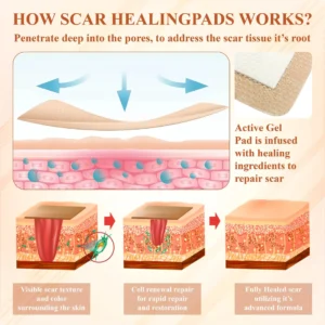 SiliconeFoam Healing Pads - Image 7