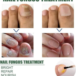 Nail Repair Serum - Image 6