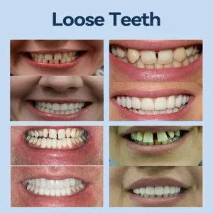 𝐌𝐞𝐝𝐢𝐜𝐚𝐥𝐅𝐢𝐭 𝐀𝐝𝐚𝐩𝐭𝐢𝐯𝐞 𝐃𝐞𝐧𝐭𝐮𝐫𝐞𝐬 - Image 7
