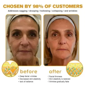 Special Discount Botox Bee Venom Wrinkle Removal Cream - Image 4