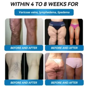 Super Concentrated Weight Loss Gum - Image 5