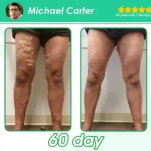 𝗠𝗲𝘁𝗮𝗯𝗼𝗹𝗶𝗰 Support – 𝗨𝗹𝘁𝗿𝗮 𝗖𝗼𝗻𝗰𝗲𝗻𝘁𝗿𝗮𝘁𝗲𝗱 𝗟𝗶𝗾𝘂𝗶𝗱 𝗣𝗲𝗮𝗿𝗹𝘀 - Image 10