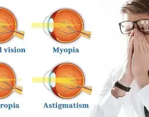Vision recovery eye drops - Image 11
