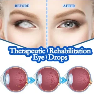 Vision recovery eye drops - Image 6