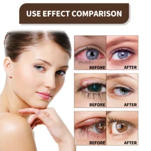 Ultra Eye Therapy Drops - Image 7