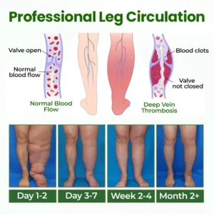 BodyRelief Circulation Cream - Image 6