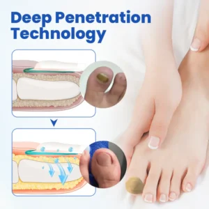 FungalPatch - Antibacterial Fungal Patch - Image 3