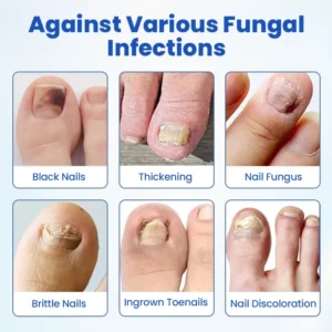 FungalPatch - Antibacterial Fungal Patch - Image 8