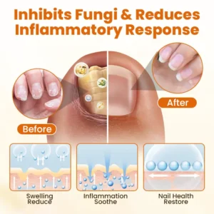 FungiBee Advanced Nail Repair Spray - Image 2