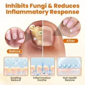 FungiBee Advanced Nail Repair Spray - Image 2