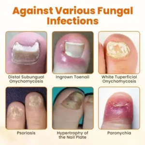FungiBee Advanced Nail Repair Spray - Image 8