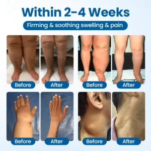 Lymphora Swelling Relief Roll-On - Image 3