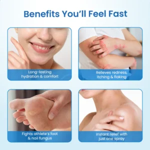MagnesiumHerb Psoriasis Relief Cream - Image 7
