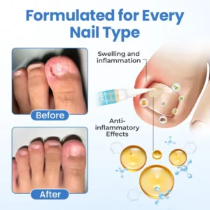 MycoErase Nail Revive Pen - Image 10
