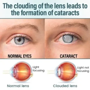 OptiFusion Nano Eye Drops Serum - Image 5