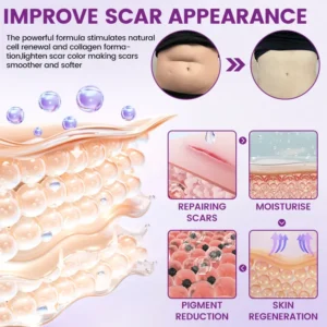 ScarVanisher Scar Gel that Visibly Reduces Scars & Stretch Marks in 2 Weeks - Image 7
