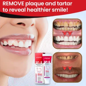 SP-6 Ultra+ Probiotic Whitening Toothpaste - Image 10