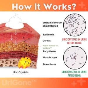 Healing Ointment for Gout - Image 3