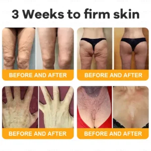 Bee Venom Skin Restoration Cream LAST DAY 80% OFF - Image 3