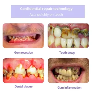 Winter Sale Teeth Restoration Mineral Powder - Image 4