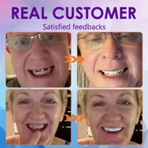 Advanced Customized Full Denture Set - Image 11