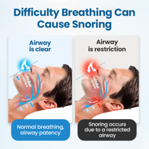 SnoreLess Nasal Breather - Image 5