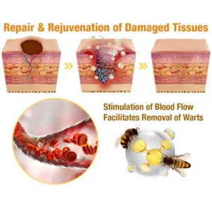 Bee Venom Mole and Wart Treatment Spray - Image 11