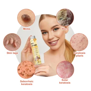 Bee Venom Mole and Wart Treatment Spray - Image 6